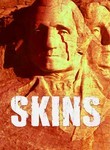 Skins
