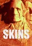 Skins